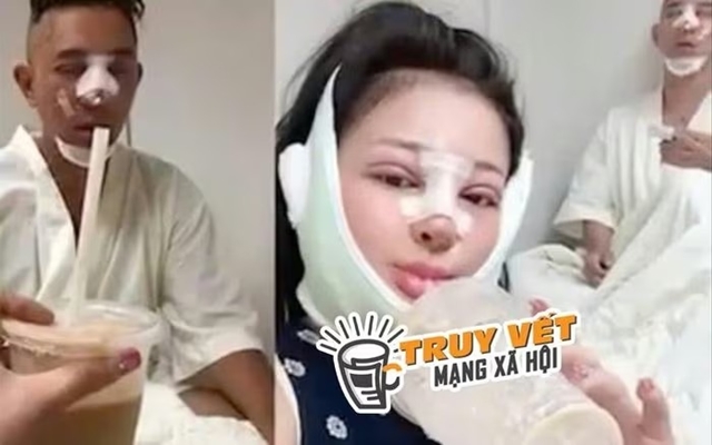 Thực hư thông tin bác sĩ Chiêm Quốc Thái là người làm biến dạng mũi của Ngân 98