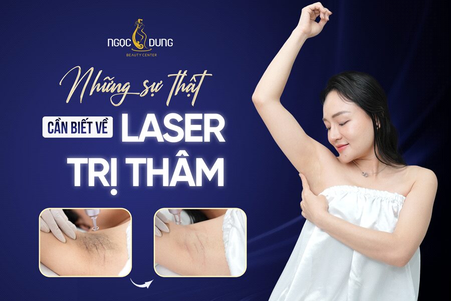 Sự thật về laser trị thâm: Điều bạn cần biết trước khi điều trị 6 Sự thật về laser trị thâm: Điều bạn cần biết trước khi điều trị su that ve laser tri tham dieu ban can biet truoc khi dieu tri