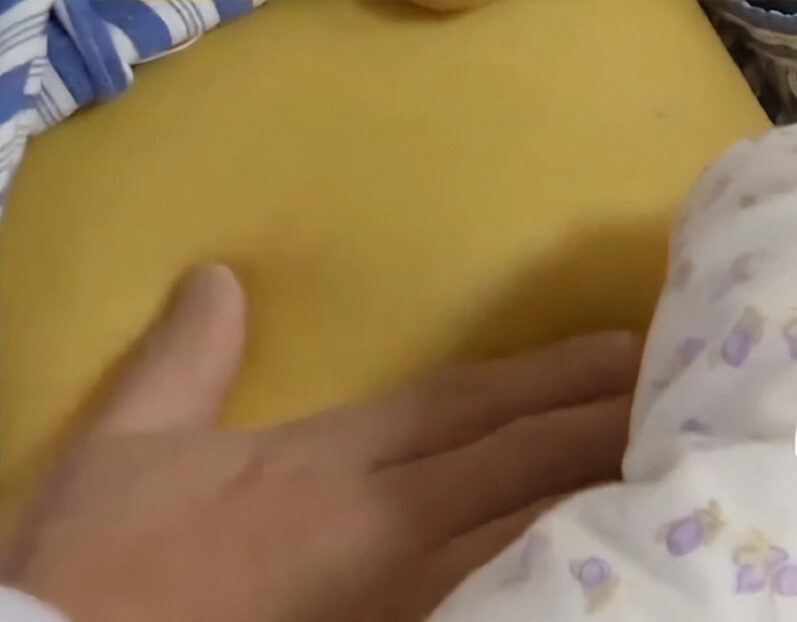 Nữ sinh 20 tuổi suy gan, da vàng như nghệ vì chăm da theo cách của nhiều người 9 Nữ sinh 20 tuổi suy gan, da vàng như nghệ vì chăm da theo cách của nhiều người nu sinh 20 tuoi suy gan da vang nhu nghe vi cham da theo cach cua nhieu nguoi