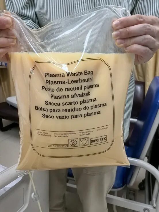 Người đàn ông 40 tuổi đau bụng dữ dội, vào viện lọc ra 3.600ml huyết tương “trắng đục như sữa” 1 Người đàn ông 40 tuổi đau bụng dữ dội, vào viện lọc ra 3